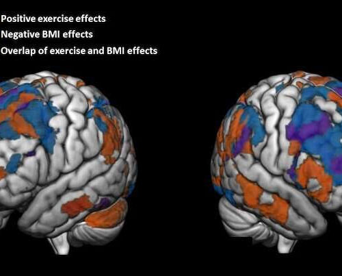 Regular physical activity linked to more ‘fit’ preteen brains