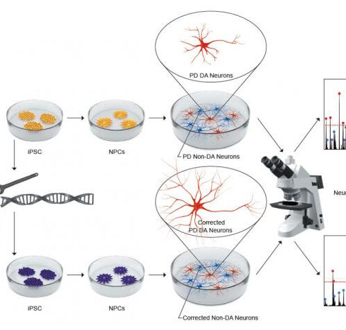 Identified an early neuronal dysfunction in Parkinson’s that could help early diagnosis