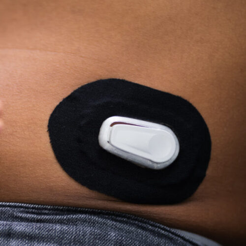 Demand is growing for continuous glucose monitoring for type 2 diabetes. Primary care doctors need to prepare