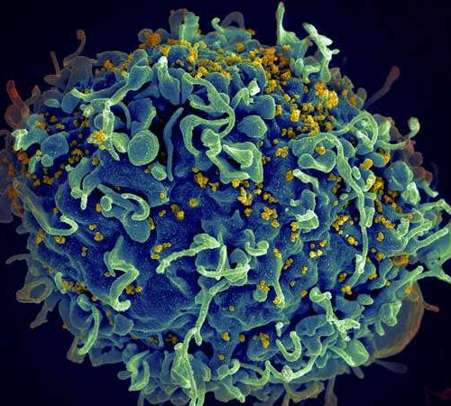 Is it possible to deliver a knockout punch to HIV?