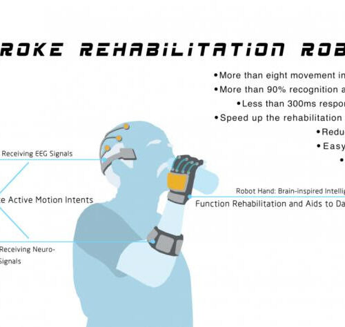 How robots and brain-computer interfaces could transform stroke patients’ recovery