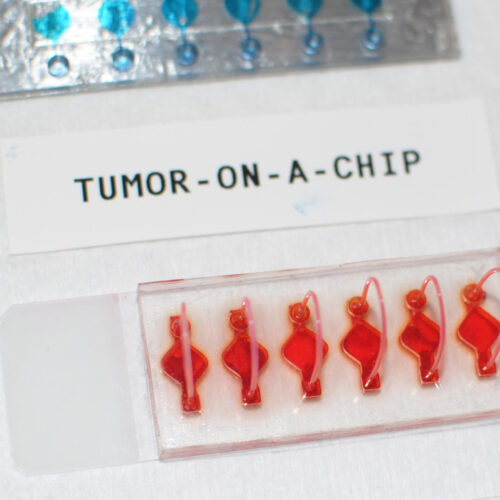 Personalized immunotherapy response studied in body-on-a-chip cancer models