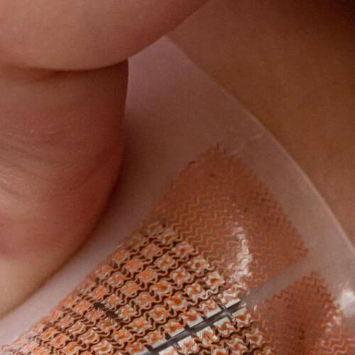 Soft skin patch could provide early warning for strokes, heart attacks