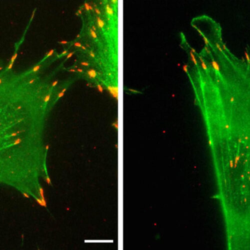 Protein’s ‘silent code’ affects how cells move