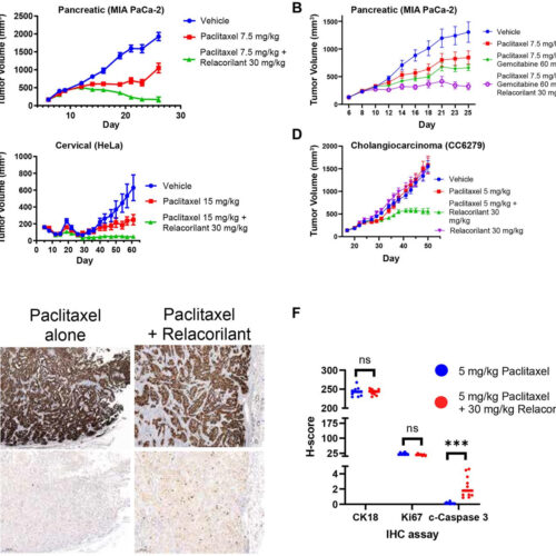 Oncotarget: Glucocorticoid receptor antagonism promotes apoptosis in solid tumor cells