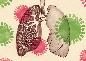 Inside the lungs, a new hope for protection against flu damage