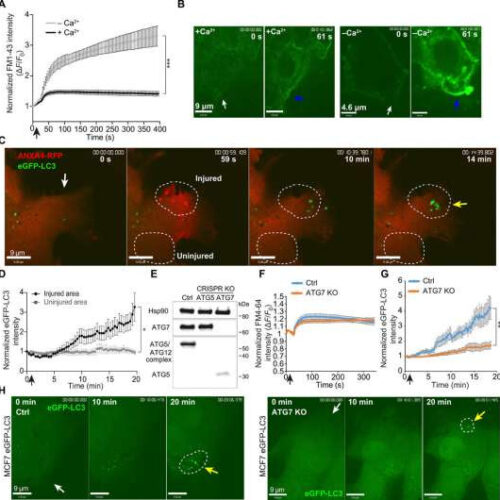 Cancer cells eat themselves to survive