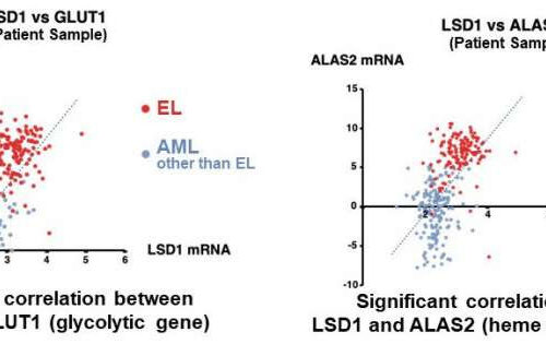 Unraveling the mechanisms that create the individualized metabolism in leukemia