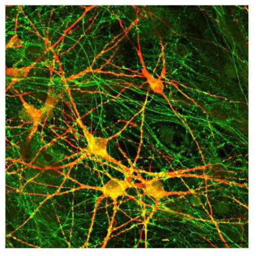 Impairments found in neurons derived from people with schizophrenia and genetic mutation