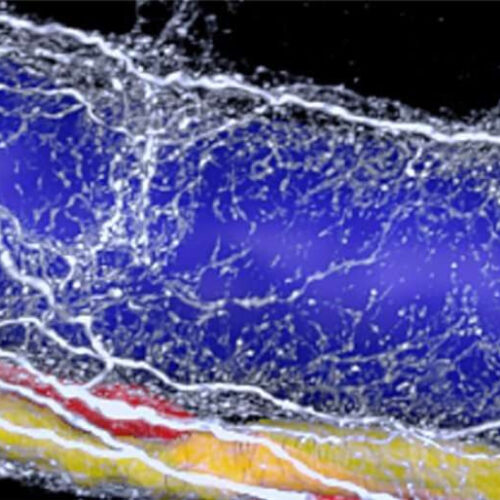 3D imaging reveals neural ‘vicious cycle’ in fatty liver disease