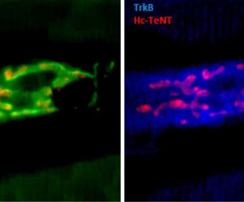 Tetanus toxin fragment may treat depression, Parkinson’s disease and ALS