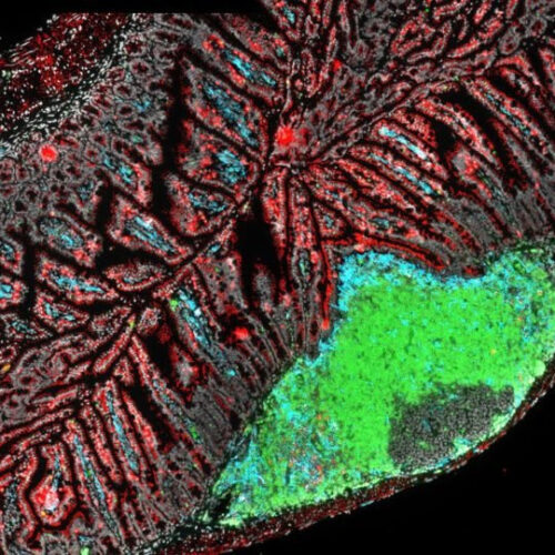 Microbiome Medicine: Scientists Harness the Body’s ‘Bugs’ to Treat Asthma, MS, and More