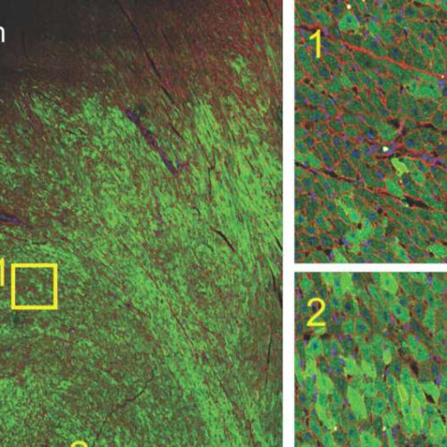 New research moves novel gene therapy for heart failure closer to the clinic