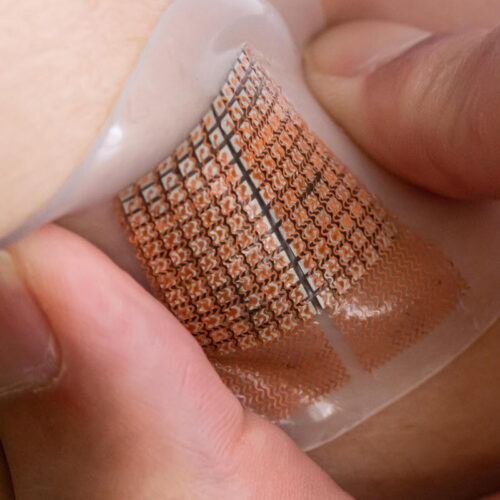 Wearable ultrasound patch could warn of cardiovascular problems