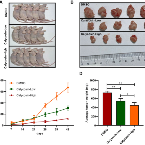 Aging-US: Calycosin inhibits breast cancer cell migration and invasion