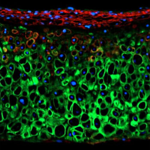 Discovery that TRPV4 gene regulates cartilage growth might yield future therapies for joint repair