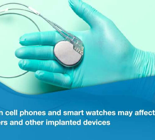 New cell phone and smart watch models can interfere with pacemakers and defibrillators