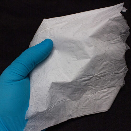 Experimental chronic wound dressing made from human protein