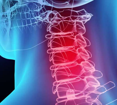 New technology holds the key to better care for whiplash injuries