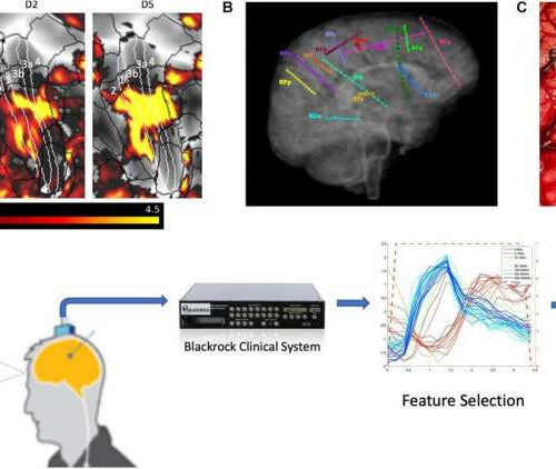 Restoring proprioception and motor control in diabetes, injury and neuropathy patients