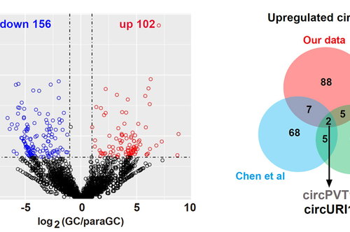 Scientists discover novel mechanism of CircRNA inhibiting gastric cancer metastasis