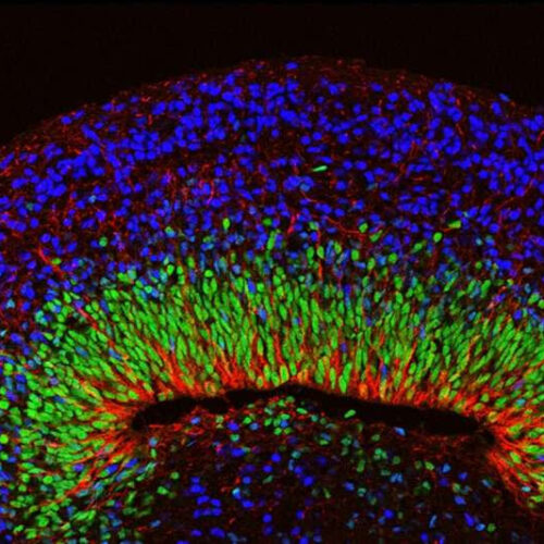 Scientists develop brain organoids with complex neural activity