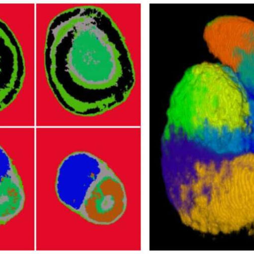 Study traces the blueprints for how human kidneys form their filtering units
