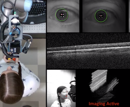 Robotic Scanner for Automated Eye Imaging