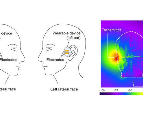 All in Your Head: Exploring Human-Body Communications with Binaural Hearing Aids