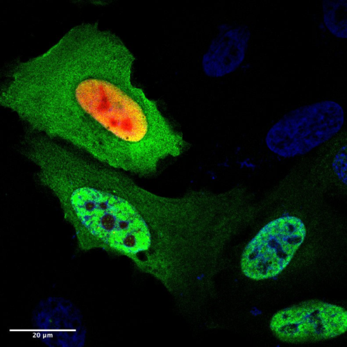 Restoring “chaperone” protein may prevent plaque build-up in Alzheimer’s