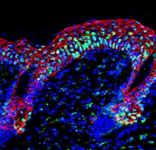 How cells draw on memories of past inflammation to respond to new threats