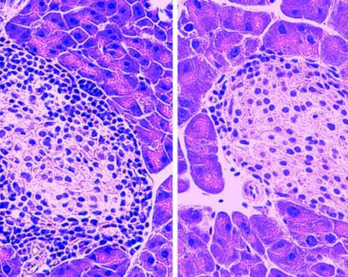 Small protein protects pancreatic cells in model of type 1 diabetes