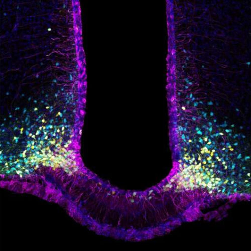 Diabetes: Study of satiety mechanism yields new knowledge