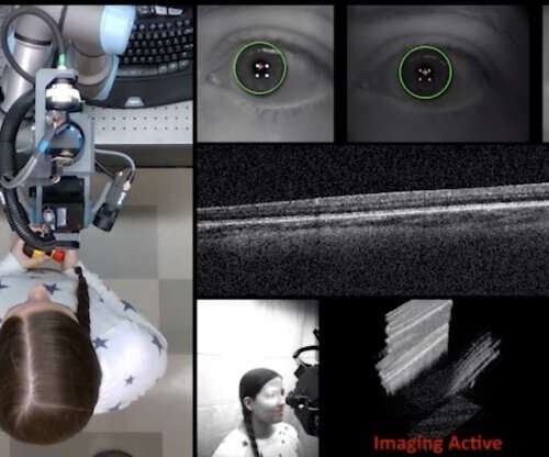 Robotic scanner automates diagnostic imaging in the eye