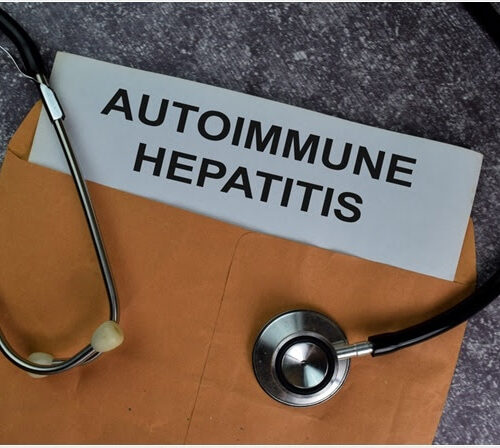 What is Autoimmune Hepatitis?