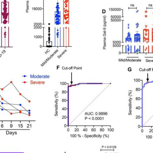 Understanding the inflammation that causes death in COVID-19 patients