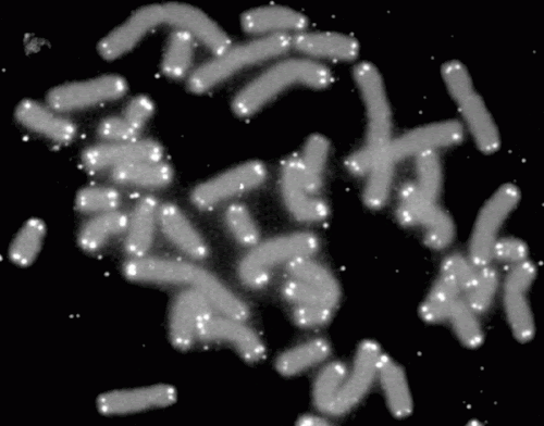 Researchers uncover new understanding of cancer cell telomere survival mechanisms