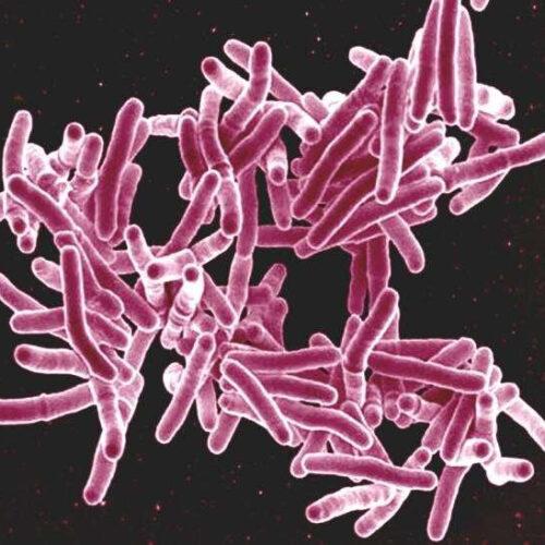 Scientists discover a surprising new way that tuberculosis suppresses immunity