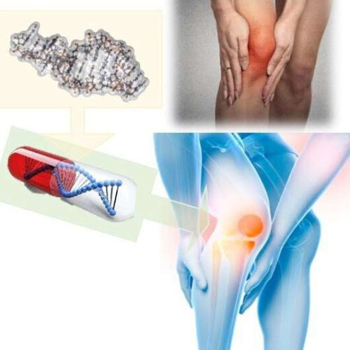 A possible new treatment for osteoarthritis joint issues