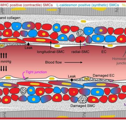 New research reveals cardiac microvascular dysfunction