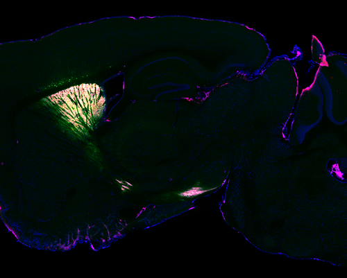 New technique identifies proteins in the living brain