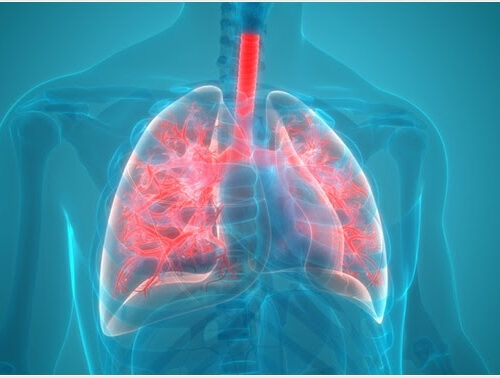 Viral vs Bacterial Pneumonia