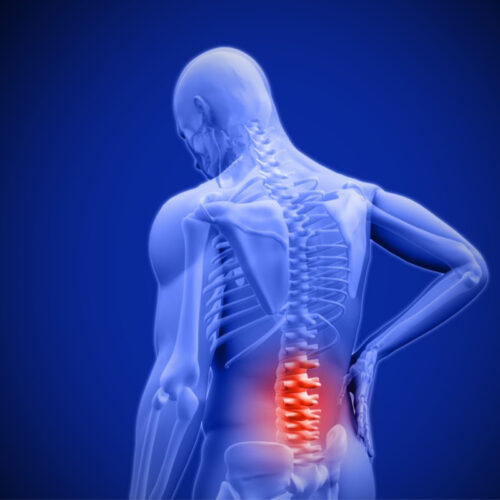 Anti-aging drugs preserve spinal discs to target age-related back pain