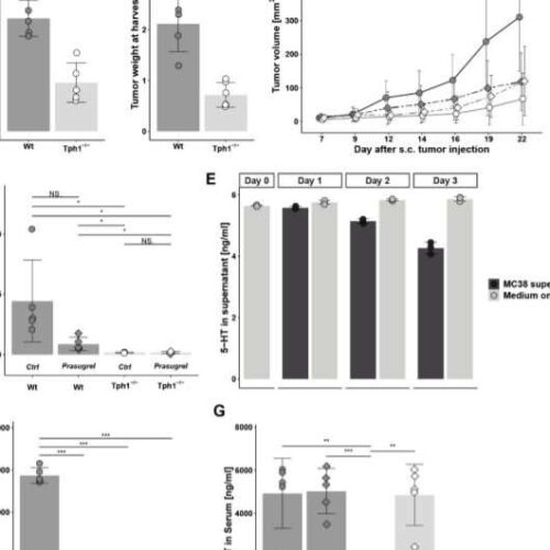 Antidepressants inhibit cancer growth in mice