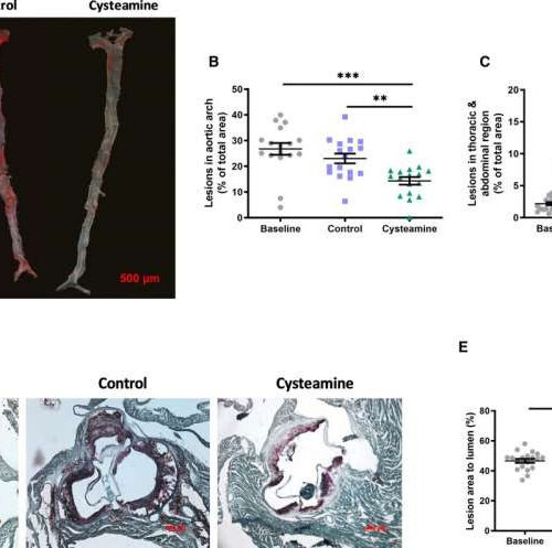 Antioxidant drug reverses process responsible for heart attacks and strokes