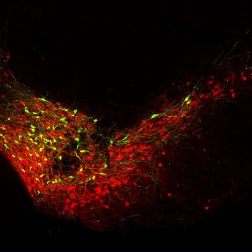 Evidence for a neuroprotective effect from transcription factor BCL11A