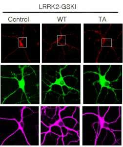 How protein clogs in cellular entrances cause Parkinson’s disease