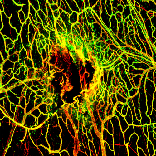 Infection hinders blood vessel repair following traumatic brain or cerebrovascular injuries