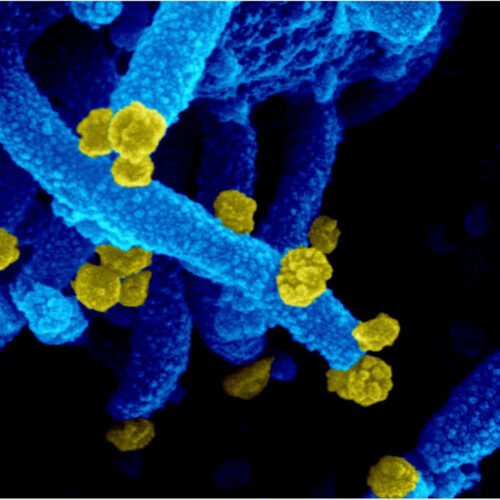 Mu SARS-CoV-2 variant highly resistant to neutralization by convalescent and vaccinated sera