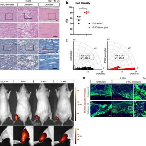 Repairing tendon injuries with stem cells